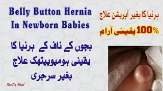 Belly Button Hernia Baby Treatment/Umbilical Hernia In Babies/Hernia Homeopathic Medicine.