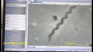 Phase-Contrast Microscopy with USB Camera System for Direct Detection of Treponema pallidum