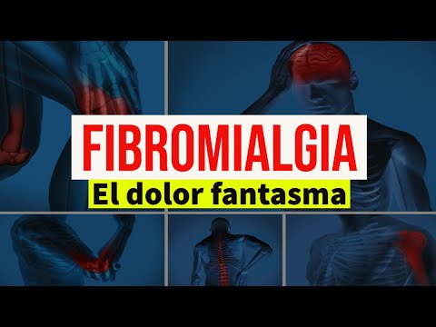 Vídeo: Erupción De Fibromialgia: Imágenes Y Tratamiento