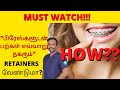How do your teeth move with braces  best teeth braces orthodontist in chennai madurai coimbatore