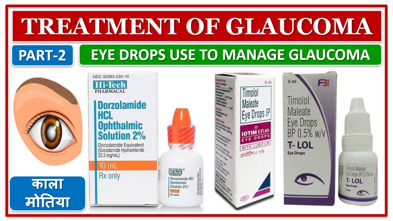 TREATMENT OF ग्लूकोमा का इलाज कैसे करे? EYE DROPS USE TO