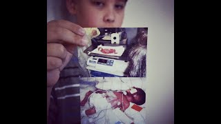 Oxnard Couple Welcomes Their Premature Baby Born At Just 23 Weeks, Now 12 Years Old.