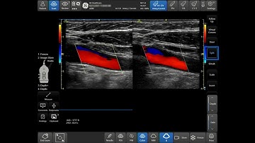 Venue™ Family R3 Tutorial - Color PDI