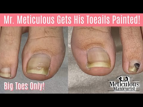 Big Toes Only