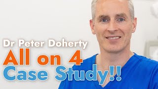 All-on-4 Dental Implants. A Case Study with Dr Peter Doherty