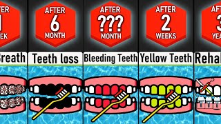 Timeline: What If You Stopped Brushing Your Teeth