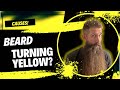 Why do beards turn yellow