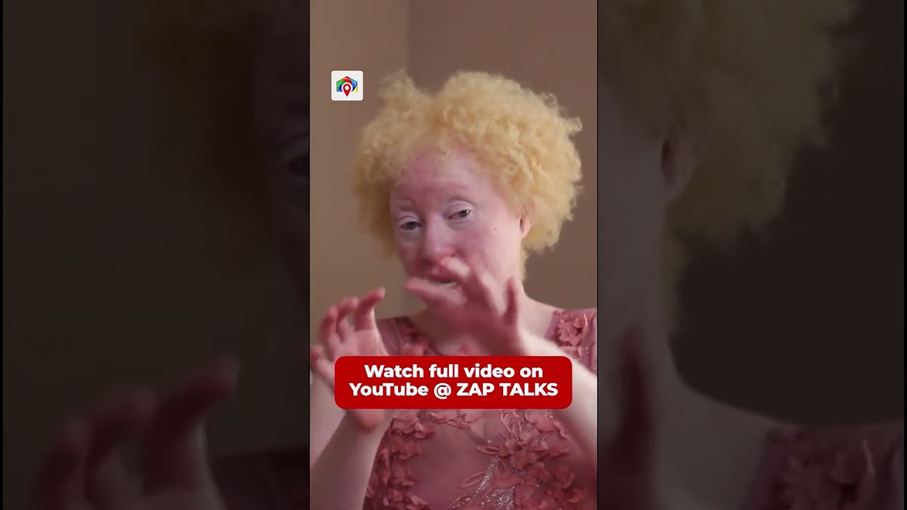 I'm seen as a magic charm #shorts #abuse #albinism