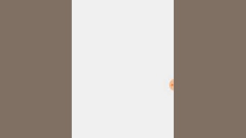 Mini militia hack/mini militia battle points hack /no root / with original game /👀