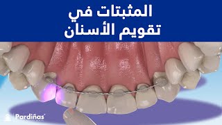 © المثبتات في تقويم الأسنان - كيفية منع تحريك الأسنان بعد تقويم الأسنان