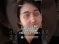 ビフォーアフター│鼻整形│短くて存在感大きい鼻の改善で垢抜けたイメージに変身🌳│ブラウン整形外科│#韓国 #韓国整形 #渡韓 #渡韓整形 #渡韓情報 #渡韓 #鼻 #鼻整形 #忘れ鼻 #鼻中隔延長