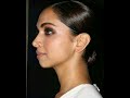 Profile Balancing | Chin Fillers | Nagpur aesthetics #chinfillers #mewing #jawline
