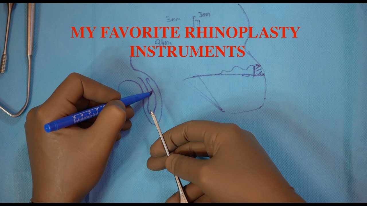 my favorite rhinoplasty instruments