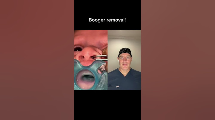 What NOT to use when removing your baby's boogers