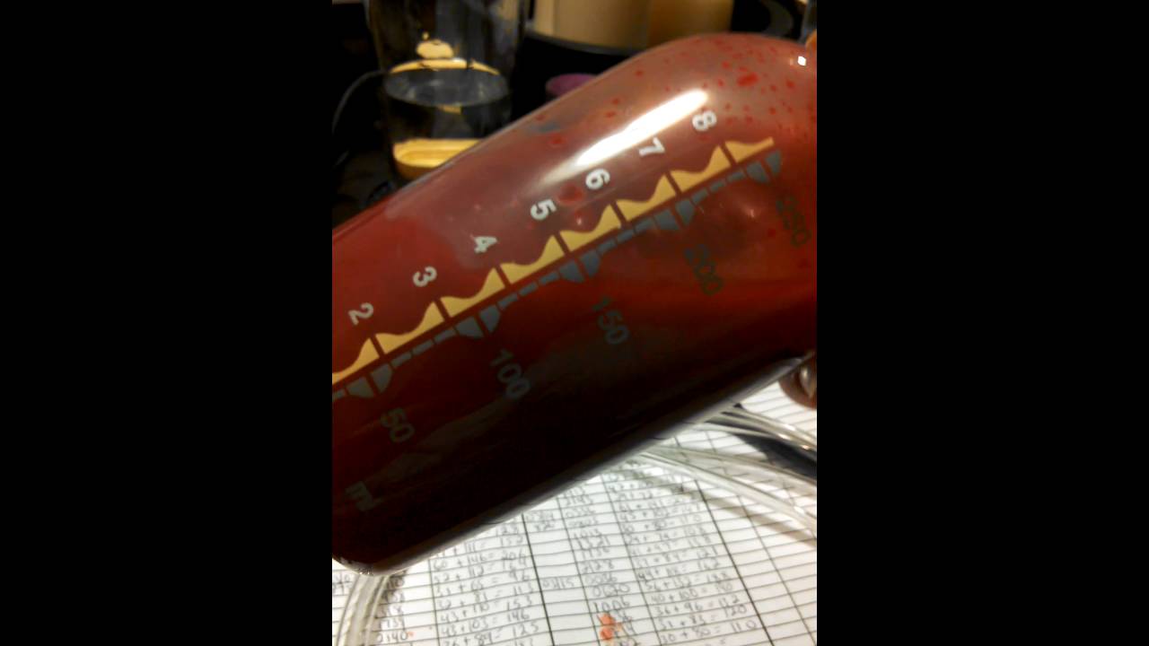 Bloody breast milk YouTube