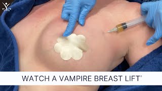 Non-Surgical Breast Lift for Better Cleavage and Natural Lift screenshot 5