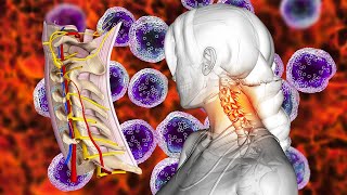 Cure Cervical Spondylosis, Cleanses Out All Negative Energy, Full Body Detox, Physical Healing