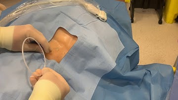 Micropuncture kit for venous access