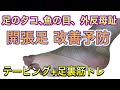 開帳足、外反母趾、内反小趾のテーピング＋足裏の筋トレ【足のタコ、魚の目、足の疲れ】簡単テーピング＋足裏と下腿部に効果的な筋力トレーニング