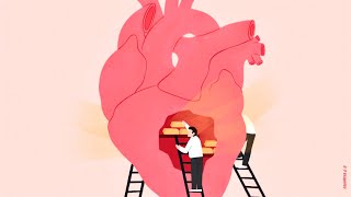 Why foreign stents still rule Indian hearts