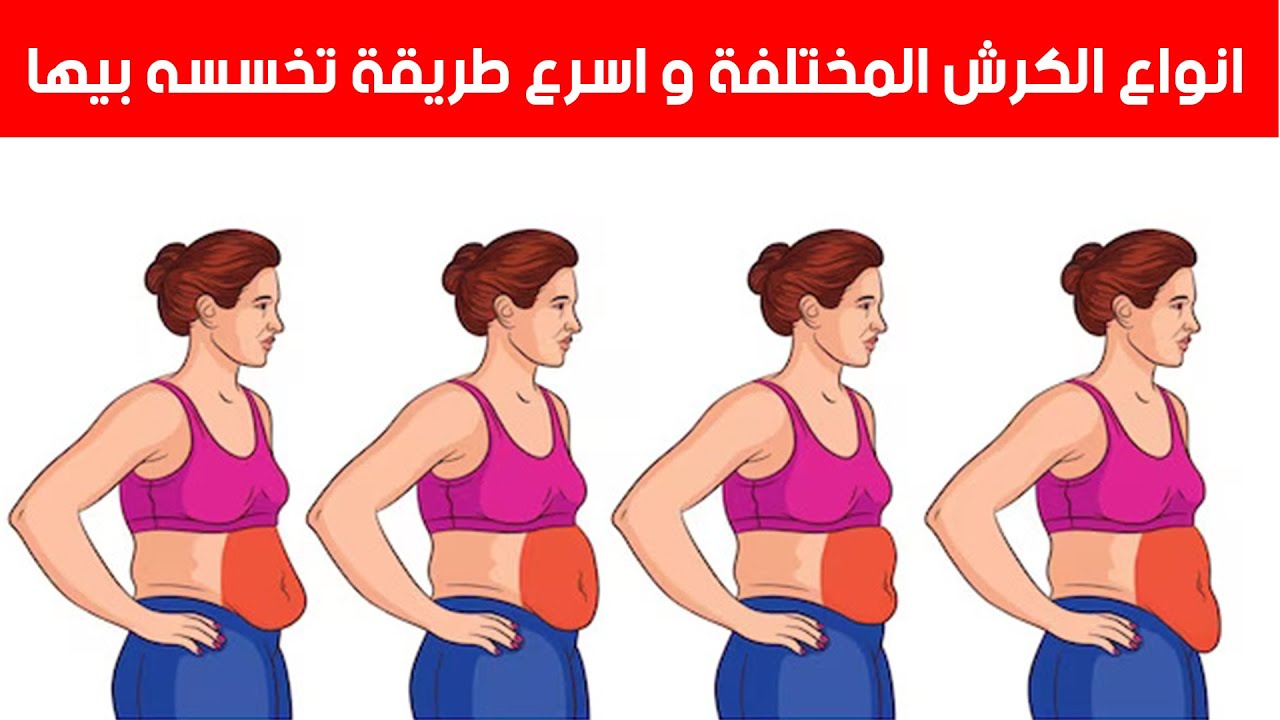 انواع الكرش المختلفة و أسهل طريقة تتخلص منه !