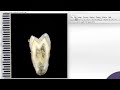 Image J: Using the polygonal selection tool