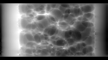 Dynamic X-ray speckle-tracking imaging based on deep learning