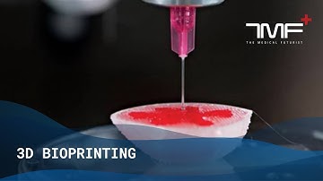 Wat is 3D-bioprinting? - De medische futurist