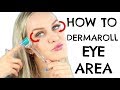 DIY Remove Undereye Bags and Crow's Feet with Dermaroller