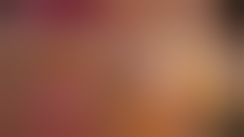 laparoscopic bilateral inguinal hernia TEP repair unedited