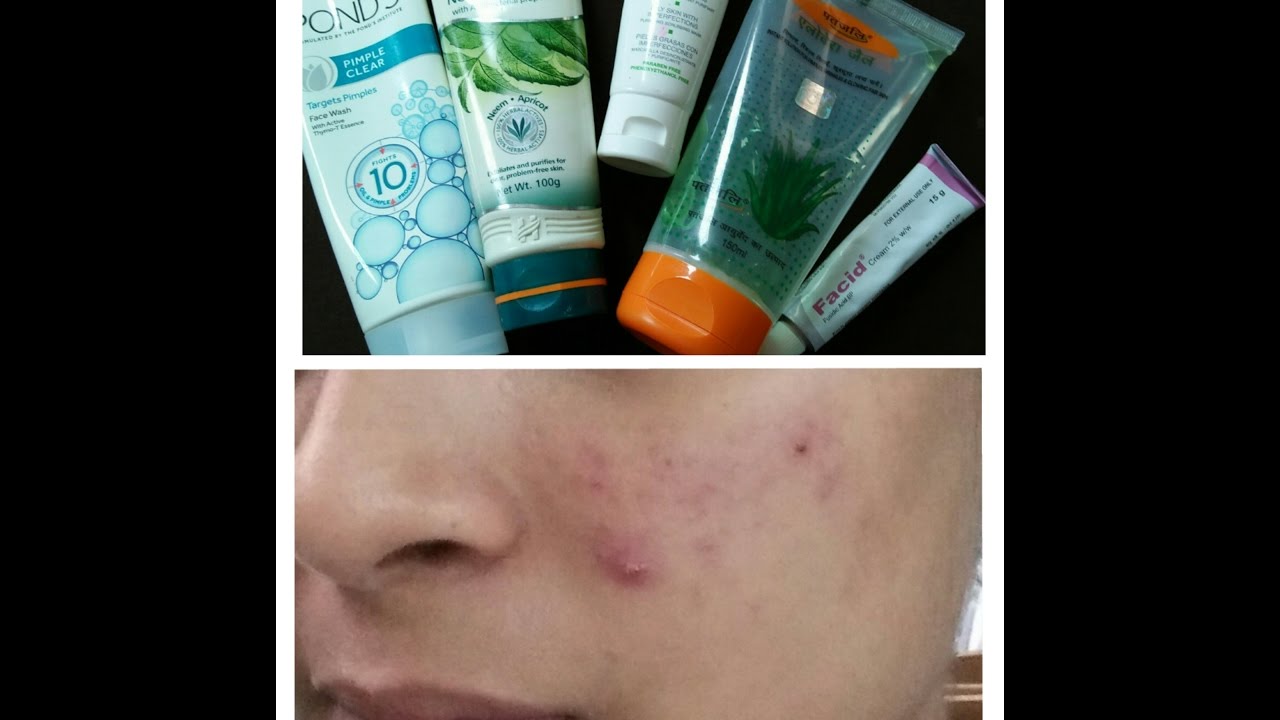 My Acne Skin Care Routine - YouTube