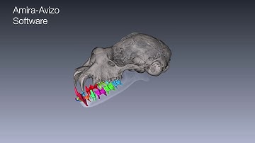 Automatic CT teeth image segmentation with Amira Software