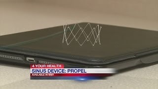 PROPEL medical device helps patients with chronic sinusitis