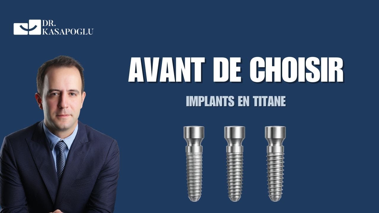 Implants en titane : comprendre les différences avant de choisir – Soins dentaires en Turquie