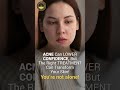 Acne is not just a skin problem it hits your confidence too. #skincare #beautyclinic#regainclinic