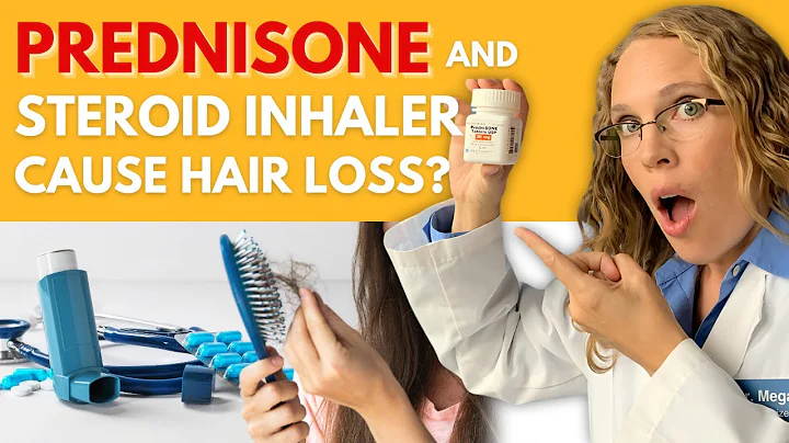 Does Prednisone & Steroid Inhaler Cause Hair Loss?