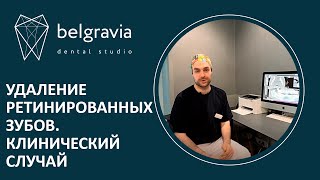 👉 Удаление ретинированных зубов. Клинический случай лечения пациента в Belgravia Dental Studio