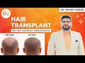 Before  after hair transplant  client testimonial  dr navnit haror  hair transplant surgeon