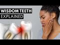 Wisdom Teeth Explained (Pain, Symptoms, & Extractions)