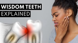 Wisdom Teeth Explained (Pain, Symptoms, \& Extractions)