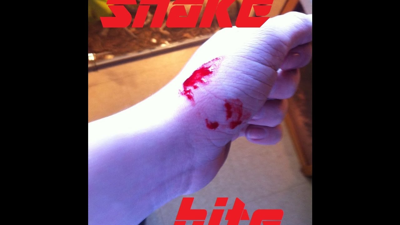 camera iphone 8 plus apk Morsure de serpent / Snake bite my hand!!