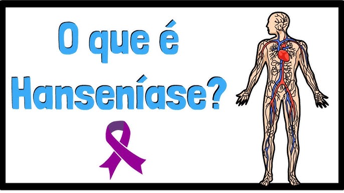 Hanseníase: o que é, sintomas, transmissão e tem cura? - Minha Vida