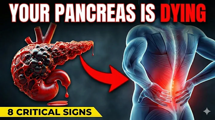 8 Symptoms of PANCREATIC CANCER That Will SHOCK YOU | Critical Warning Signs| Health Care