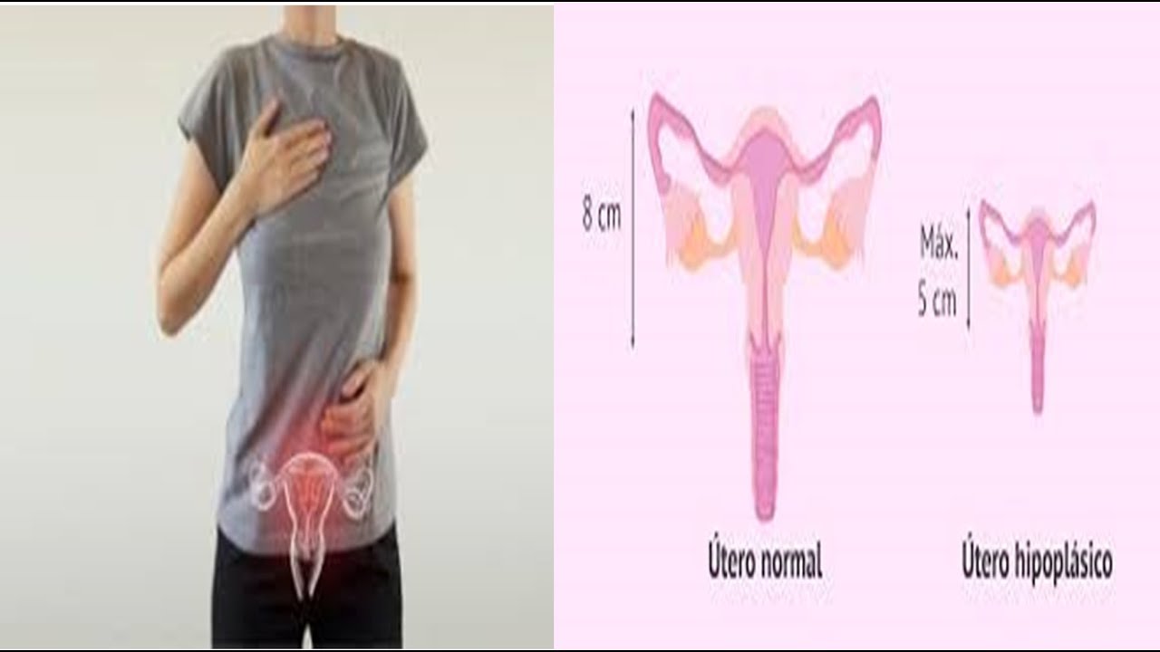 Qual é O Tamanho Do Utero Normal - FDPLEARN