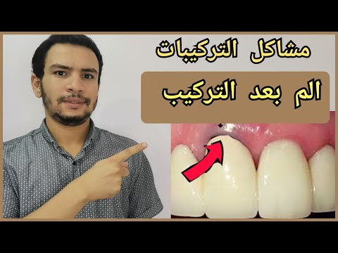 بعد تركيب الاسنان هناك الم عند استخدام التركيبه ما الحل ؟