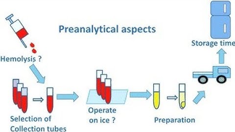 Pre analytical factors that affect result Quality control in the laboratory