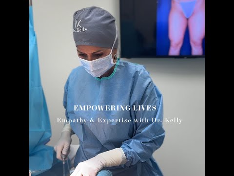 Patient journey - Liposuction by Dr. Kelly #liposuction #bodycontouring #cosmeticsurgery