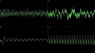 [oscilloscope] purple motion - fracture in space