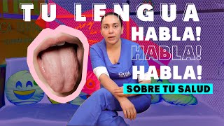 Qué esta diciendo tu lengua sobre tu salud? | Oralnet