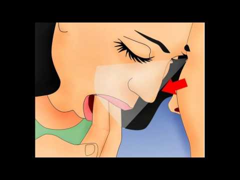 Come indurre il vomito